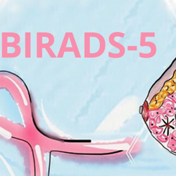BIRADS-5 nədir?